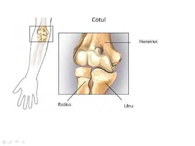 Fractura: tipuri de fracturi, simptome, complicaţii şi tratament