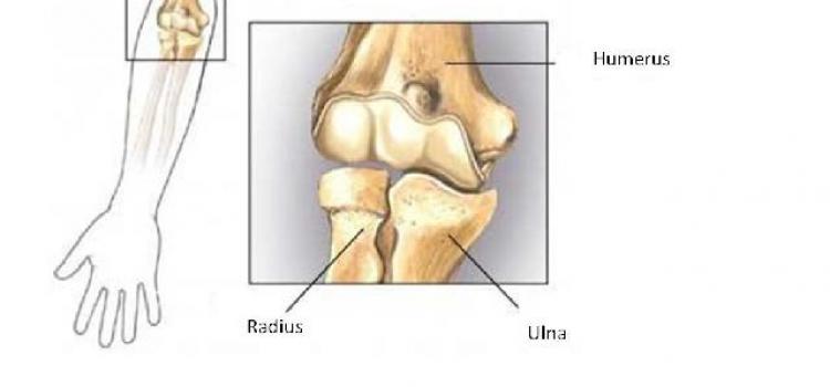 semne de artroză a gleznei comprimate pentru durere în articulațiile coapsei